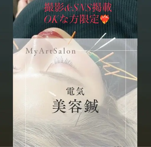 🌼SNS掲載OKな方限定🌼美容鍼🌼に本数増量❣️電気追加❣️プレゼント🎁