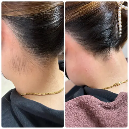 人気の脱毛メニュー🤎【うなじwax✖️痛くない光脱毛💆♀️】