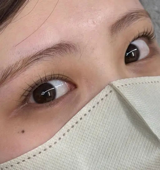 マツパ