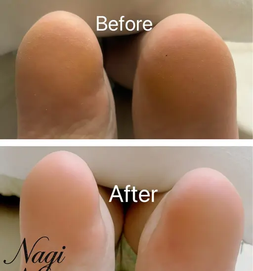 角質ケア、フットケア