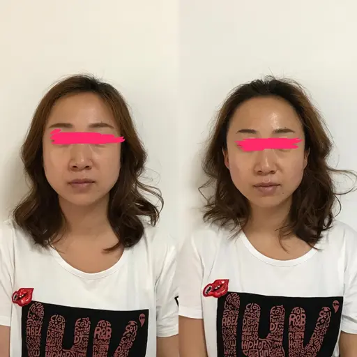 【ご新規様限定】波指法ドライヘッドスパ小顔効果❗️眼精疲労、頭痛に❗️ケア30分