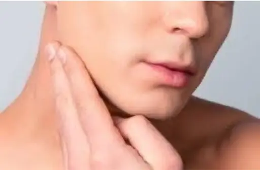 フェイス減毛