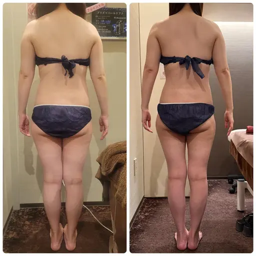✨89%off✨結果重視の本気の痩身全身ケア🔥オーダーメイドでスッキリメリハリボディへ👯♀️