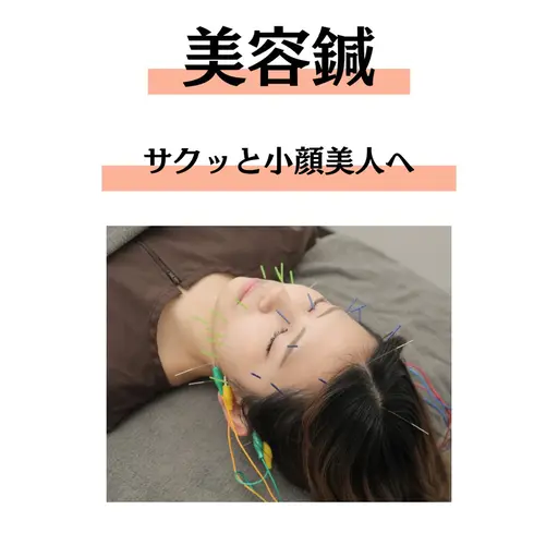 【🪡初回限定🪡】美容鍼(45分)