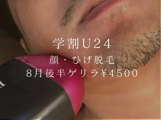 【ミニモ学割】8月後半ゲリラ‼️顔・髭ヒゲ脱毛¥10000→¥4500