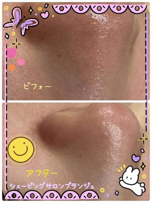 【毛穴・角質ケア】美肌シェービング+炭酸ヘッドドライスパ