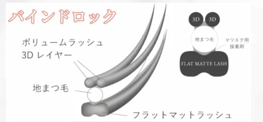 バインドロック 100