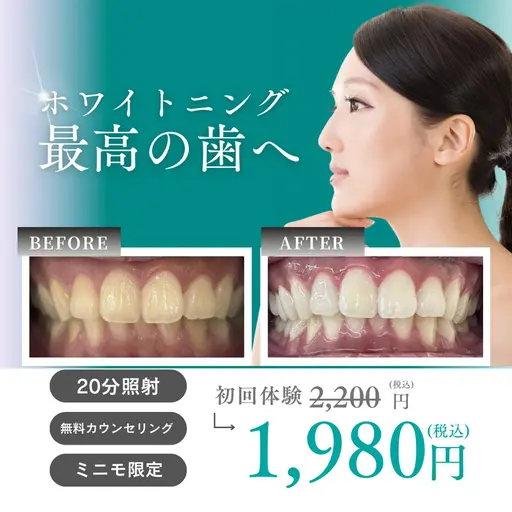 【ミニモ限定20分照射¥1980】セルフホワイトニング初めての方、隙間時間に試してみたい方必見!!