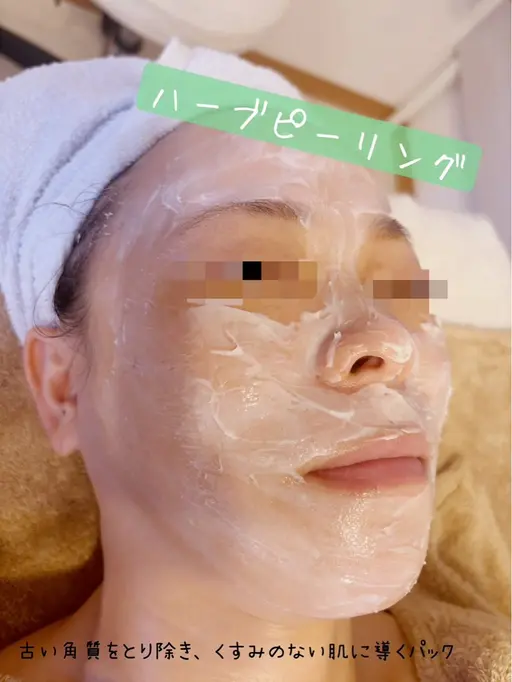 ノーダメージハーブピーリング
