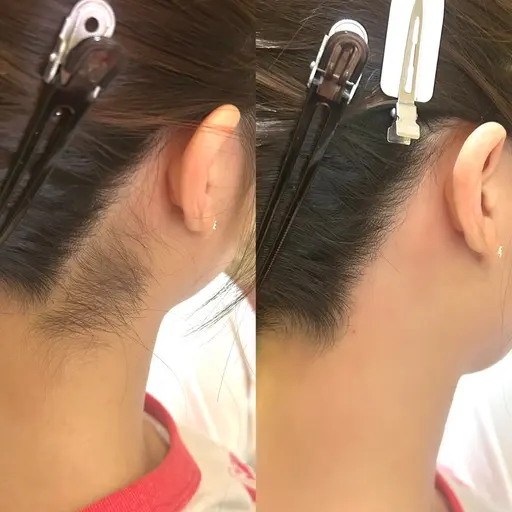 🌻うなじワックス🌻