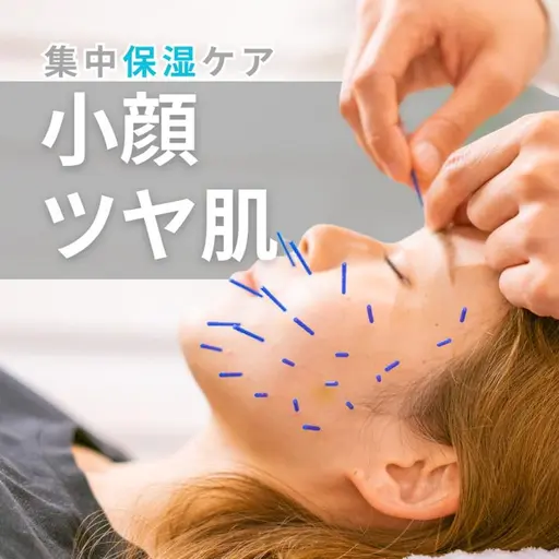 17日限定🌿美容鍼80本コース《集中保湿美肌ケア》お顔の土台から整え、血色アップ小顔&うるツヤ肌