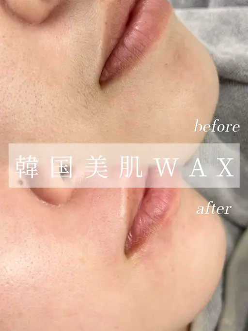 韓国美肌💗艶肌フェイシャルwax🫧