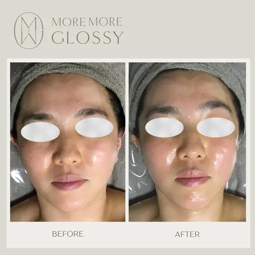 人気No.1💎眠れる美女コルギ70分/お悩み別に特化した施術で理想のフェイスラインに◎💆
