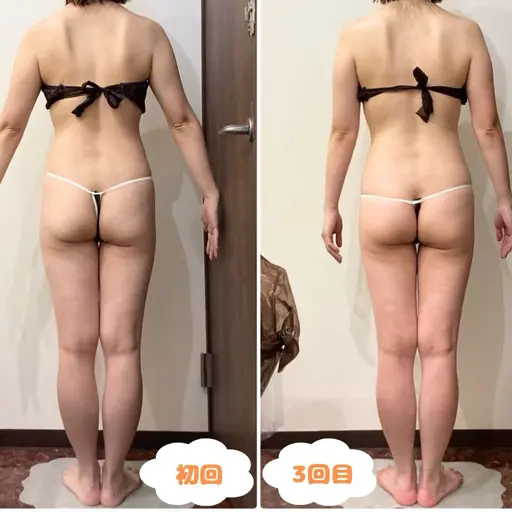 【5/28・29・30限定】お悩み別痩身&脱毛お好きな箇所3ヶ所の特別メニュー🔥痩身や脱毛が気になってた方はチャンス✨