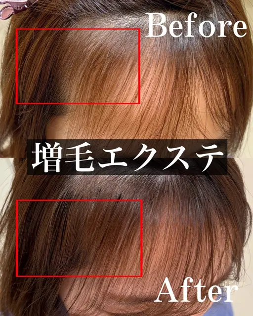 LED増毛エクステ（前髪or生え際orつむじのうち1箇所）+馴染ませカット