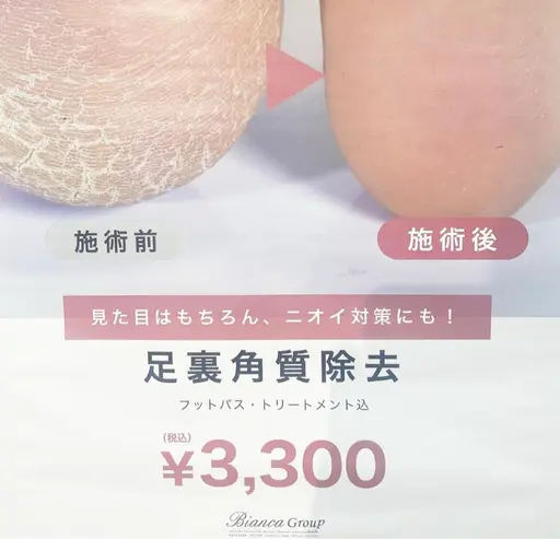 🪽気になる臭い•カサカサ改善　角質ケア🪽‪ 赤羽/王子