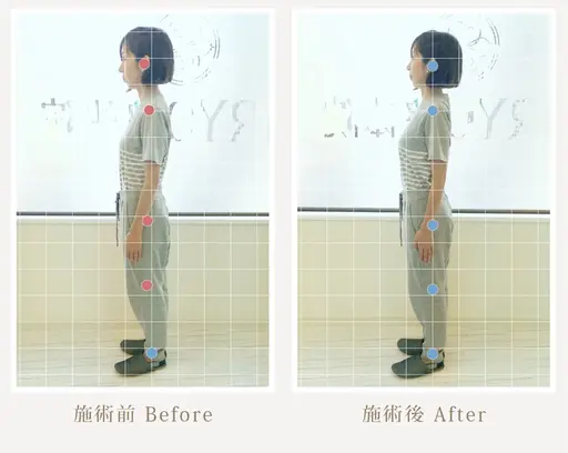 美姿勢矯正コース(スマホ首、巻き肩、猫背、肩こり、腰がつらい方、姿勢が悪くカラダの歪みが気になる方にオススメ)