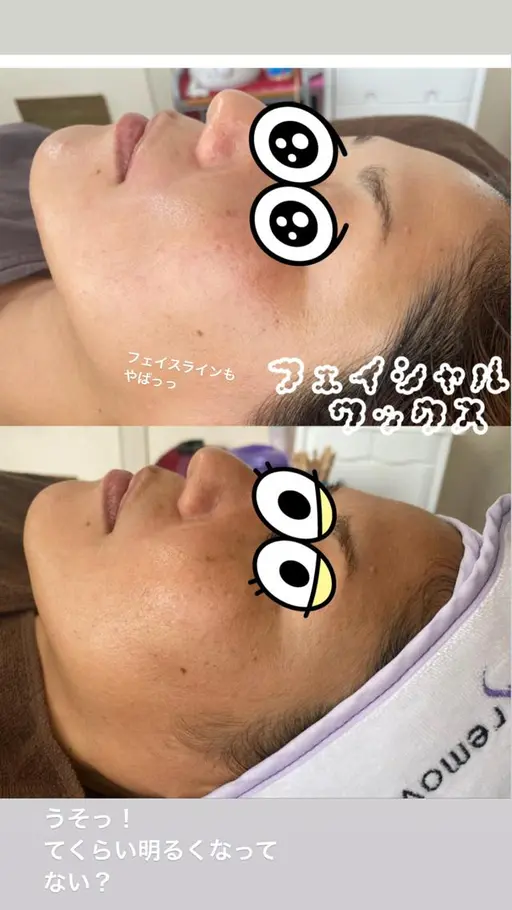 【モニター価格!!】フェイシャルWAX♡♡