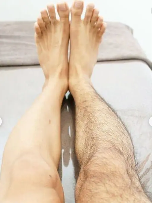 メンズ男性脱毛　腕手足