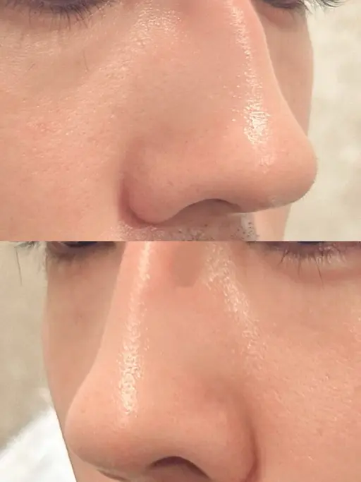 鼻毛wax👃