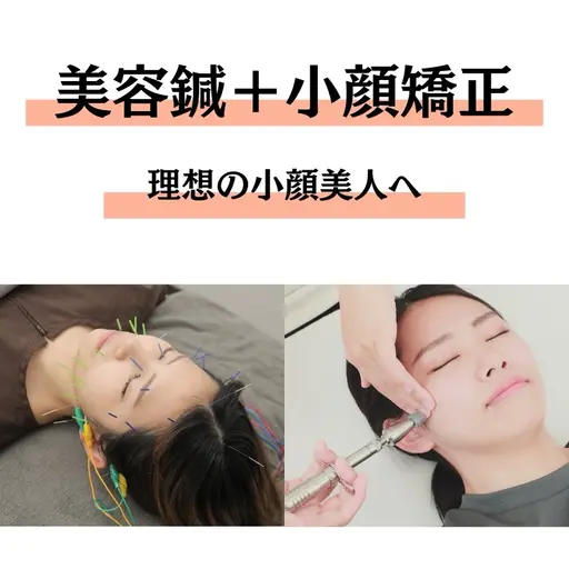 《🪡初回限定🪡》美容鍼+小顔矯正+ドライヘッドスパ(60分) 💄メイクオフ不要💄