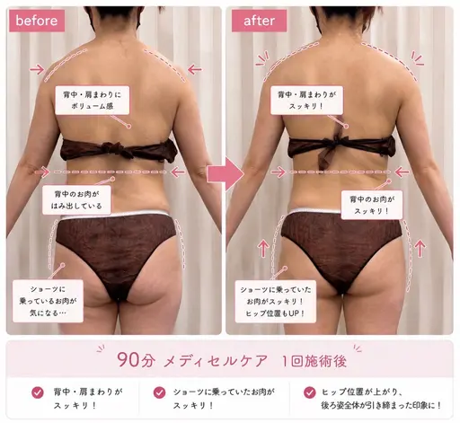 全身メディセルエステ13,200円→2,980円