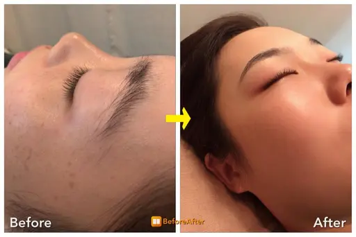 まゆげワックス(ワックス脱毛) |眉毛の黄金比測りまゆWax脱毛します。細かい毛はツイーザーや剃刀でも処理
