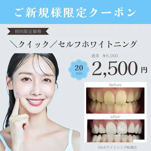 【今月限定】Google口コミで⭐︎クイック⭐︎セルフホワイトニング¥6,000→¥2500(照射時間20分)