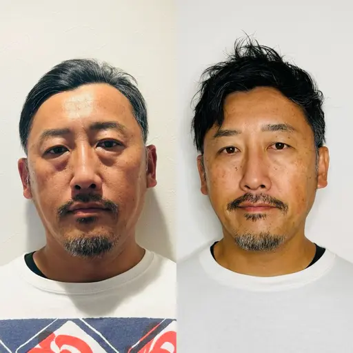 【メンズ限定】👨minimo限定✨脅威の効果実感率100%ビューティーライザー¥18000→¥10000