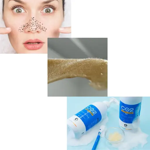 【見て触ってその場で実感！】鼻毛穴洗浄+鼻WAX+肌質改善高濃度炭酸トリートメント