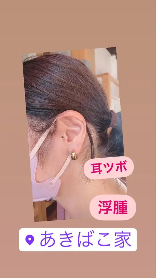 ヒト幹細胞培養液スプレー+耳ツボジュエリー💎