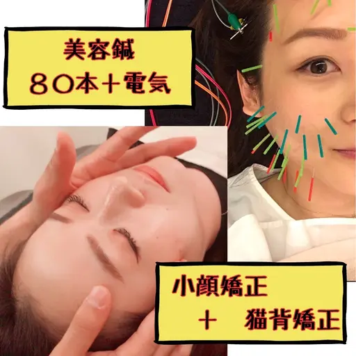 美容鍼＋小顔矯正🌟80​〜​100本使用🦔パルス⚡️有り！猫背矯正付き🐈