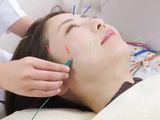 🔰初めての美容鍼✨むくみ・疲れ顔をすっきり|フェイスラインケア