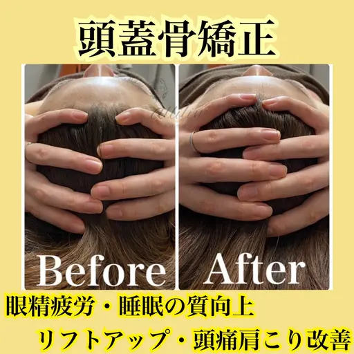 🌻自律神経の乱れを根本解決🌻上半身筋膜リリース+頭蓋骨矯正+小顔 90分¥33,000→¥3,300🌿