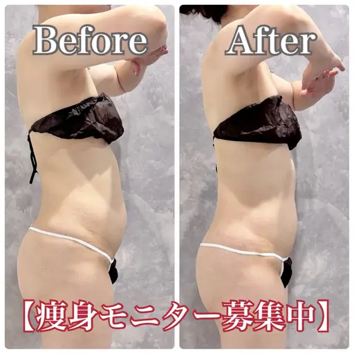【導入モニター】腰回り&お腹集中◆脂肪AI測定×超音波60分