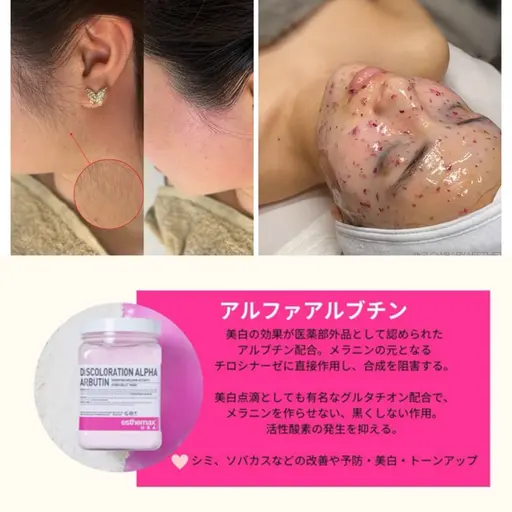 フェイスワックス+もみあげ+美白パック🪞🫧 産毛と一緒に古い角質も取れるので、トーンアップ・メイクノリUPに