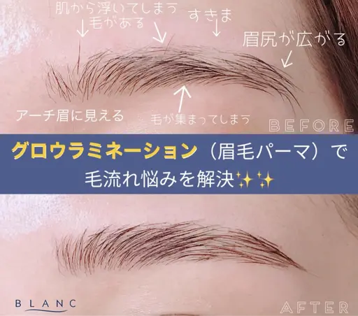 グロウラミネーション(眉 毛流れ矯正)