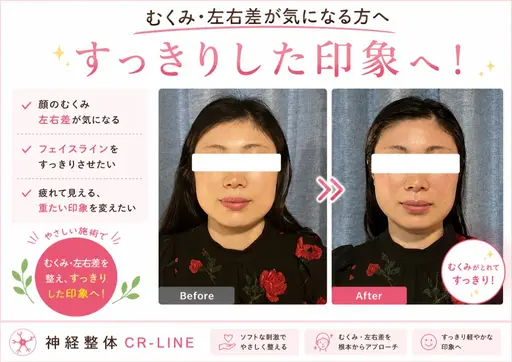 《美容整体》違いがでる小顔ケア✨