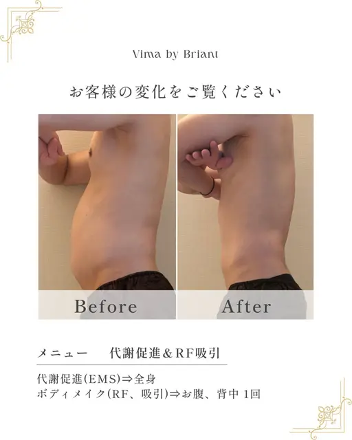 【ボディメイク🤩】1部位 20分 モニター✨️パーツ痩せ/イベント前🌞🌴🌺✨/20分で楽ヤセ✨️ボディライン整う