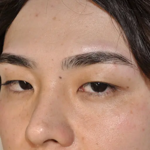 【ミニモ限定価格】小鼻のうぶ毛・ざらつきをオフ◎メンズ眉&小鼻ワックス ¥7,000