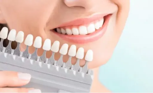 🦷速攻白く🦷【セルフホワイトニング✨2日分】45分¥5000💖コスパ最強