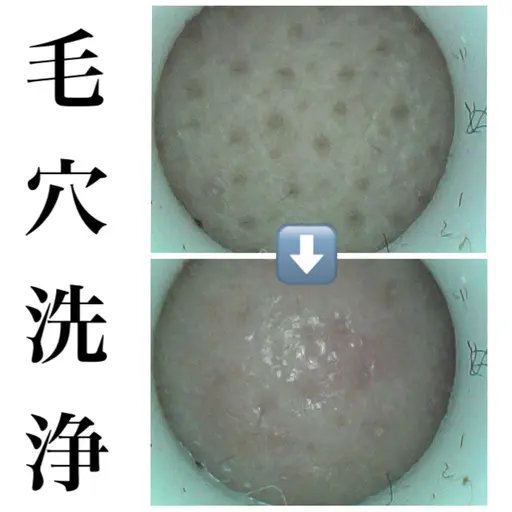 つるつる🫧毛穴洗浄🧽マイクロスコープで毛穴診断付🔍