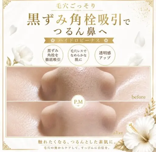【鼻の毛穴集中】ハイドロビーナス黒ずみ・角栓ごっそり吸引 ¥5,500