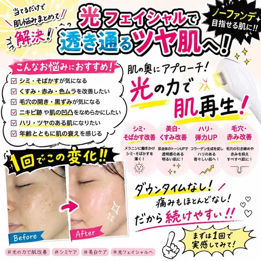 【肌管理】光フェイシャル♪くすみ・毛穴が気になる方に
