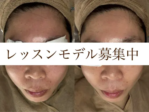 40代以上✨動画、写真撮影ご協力いただける方のみ✨フェイスラインスッキリ、くすみ解、(ご来店初めての方、女性限定)