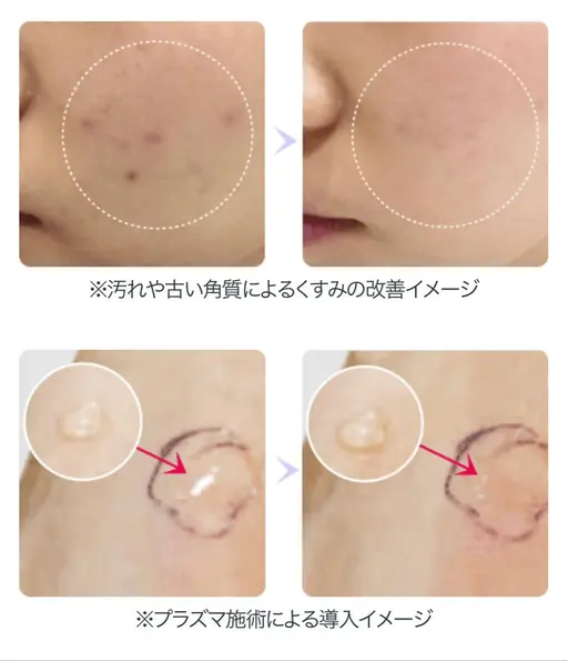 【第一印象UP】お肌の治安を守る👶プラズマシャワー