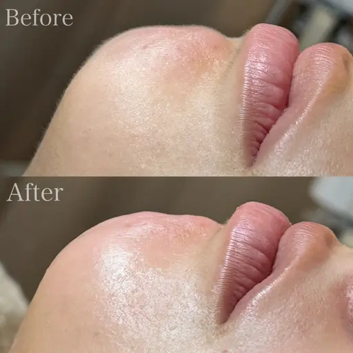 フェイスWaxモデル+フェイスパック🍑 ⚠️8/16以降は銀座一丁目店でのご案内となります。