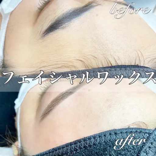 フェイシャルワックス＋鎮静パック付き