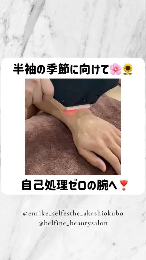 ５周年記念特別価格🉐全身脱毛ツルツル脱毛