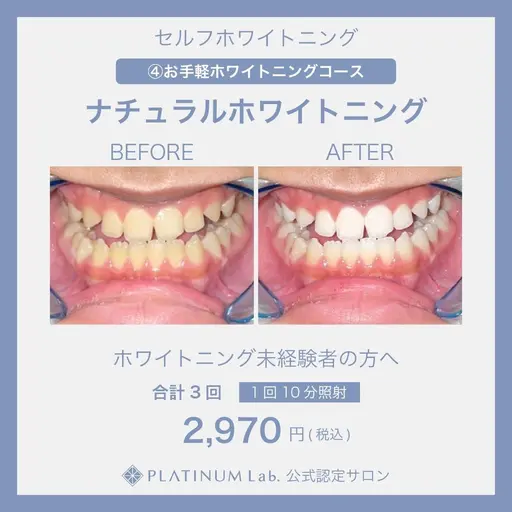 【限定クーポン❣️お試しコース】自然なツルピカ歯になります🦷✨ ナチュラルセルフホワイトニング(30分)